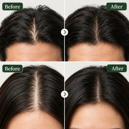 Korean Scalp Revival Bar
