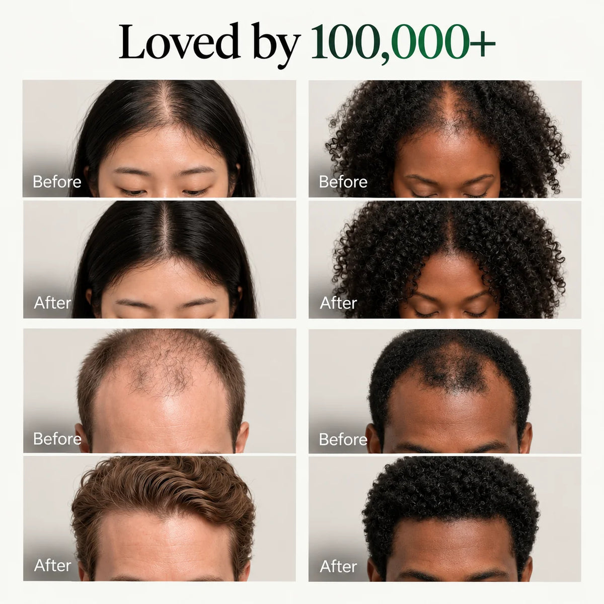 Korean Scalp Revival Bar