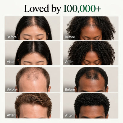 Korean Scalp Revival Bar